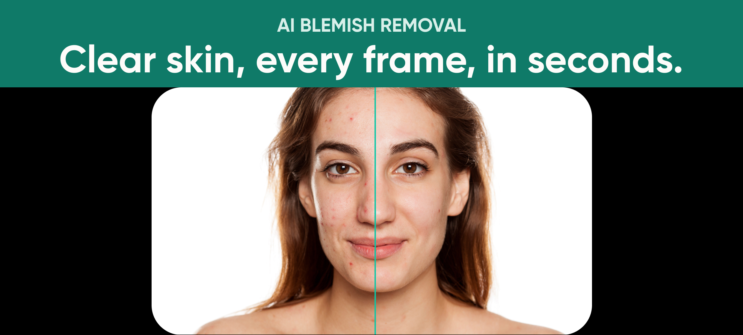Perfectly Clear offers AI Blemish Removal in Retouching suite